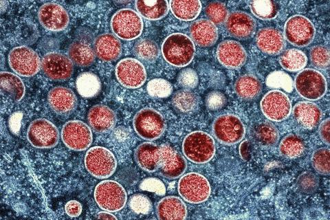 Eine kolorierte mikroskopische Aufnahme von Partikeln des Affenpockenvirus (rot) in einer infizierten Zelle (blau), die allerdings im Labor gezüchtet wurde.                Foto: dpa