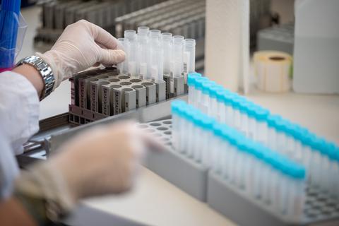 Eine Labormitarbeiterin bereitet im Bioscientia MVZ Labor Mittelhessen Teströhrchen für einen PCR-Test vor.   Foto: Sebastian Gollnow/dpa