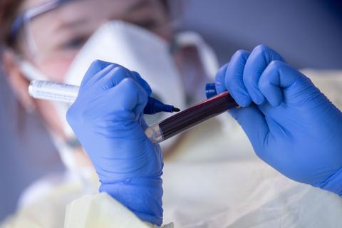 Ein Mitarbeiterin des Robert Koch-Instituts beschriftet eine Blutprobe für einen Antikörpertest.  Foto: Marijan Murat/dpa